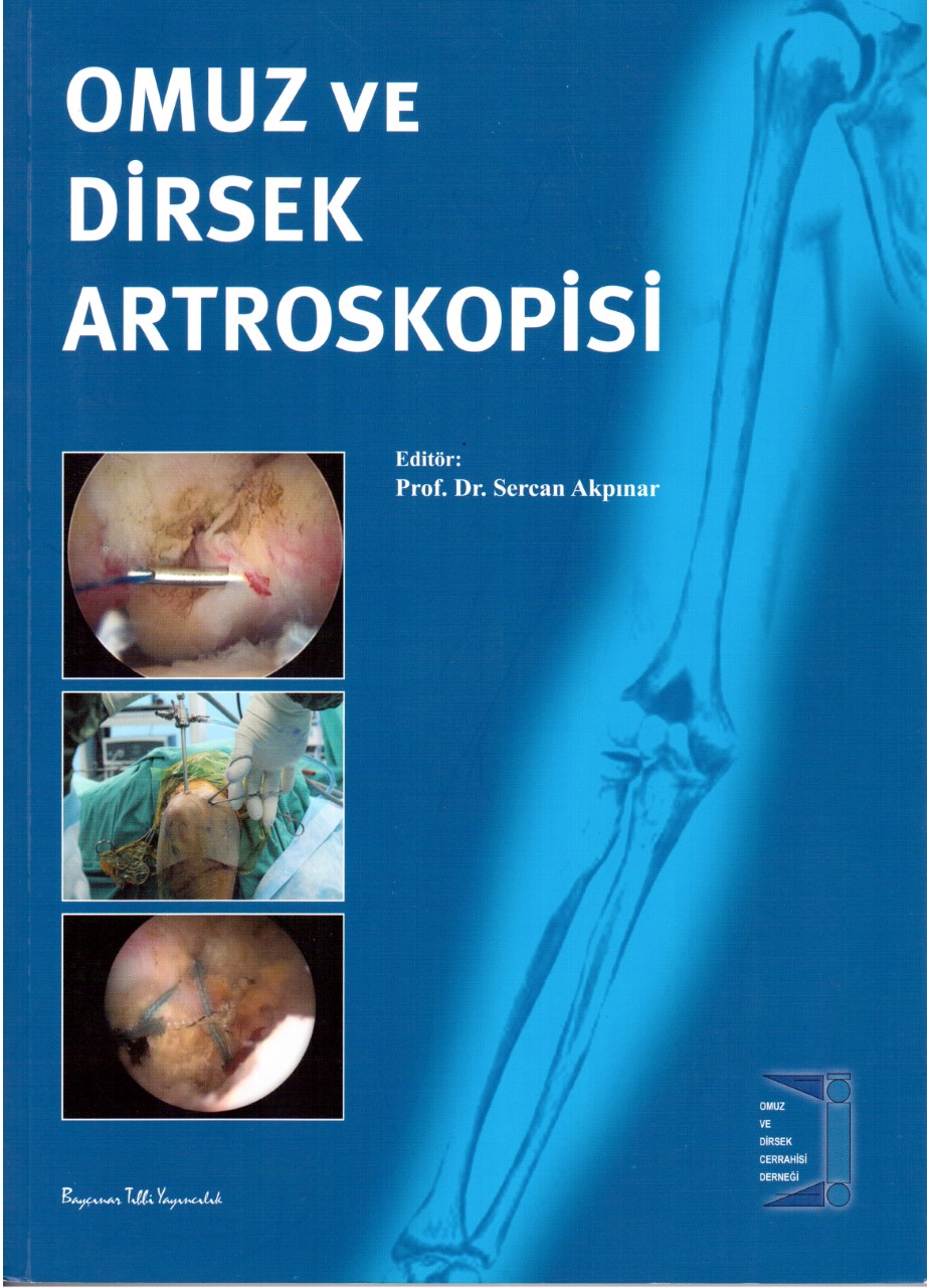 Omuz Dirsek Artroskopisi