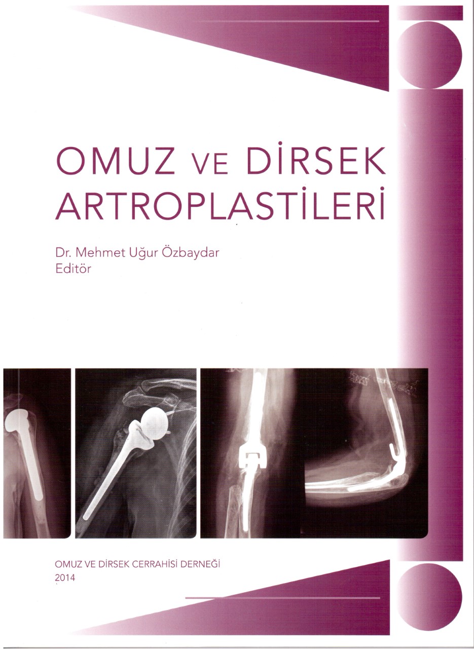 Omuz ve Dirsek Artroplastileri